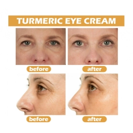 Eelhoe Turmeric Eye Cream Fade Eye Corner Fine Lines and Dark Circles Dark Circle Removal Anti-Wrinkle Brightening Skin Makeup